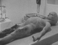 alien_autopsy