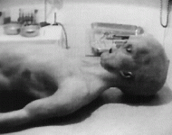 alien_autopsy_side