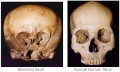 Starchild_Skull_Comparison
