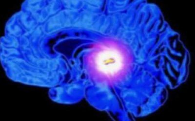 Dr. Manfred Doepp about the Pineal Gland & 4G Wireless Assault