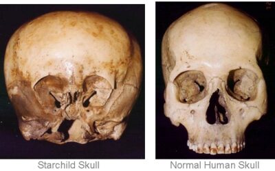 Starchild DNA:Skull Likely Not Human, Possibly ET