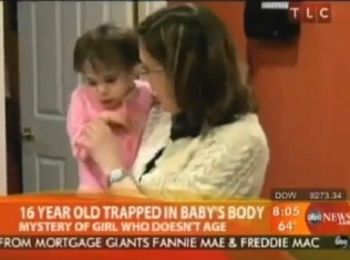 Medical Mystery – 16 Year Old ‘Baby’ Doesn’t Age